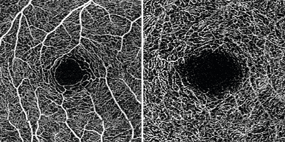 Select-Findings-From-the-AAO-Annual-Meeting