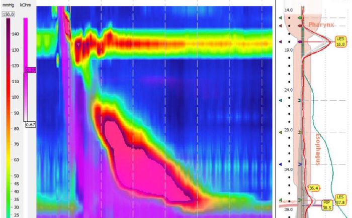 Patient's manometry