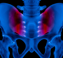 Color xray of lower spine