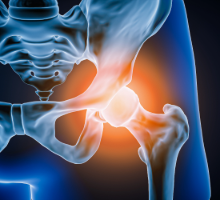 Illustration of hip joing