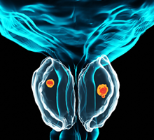 Illustration of prostrate
