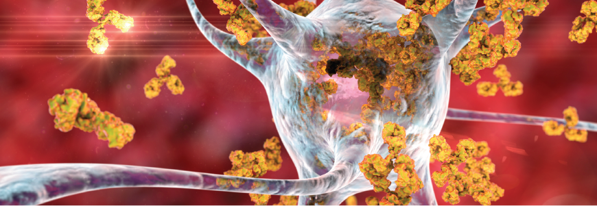 Antibodies attacking neuron, 3D illustration