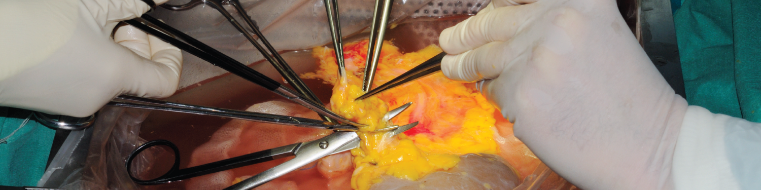 Close up image of transplant operation