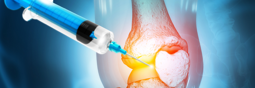 Anatomy Human Knee Joint Treatment, Osteoarthritis Injection