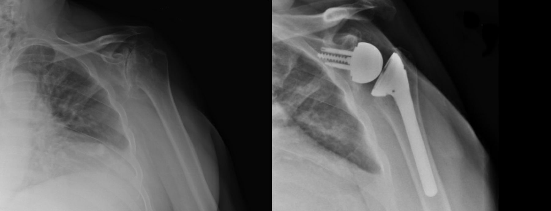 Patient's pre- and postoperative axial radiographs.