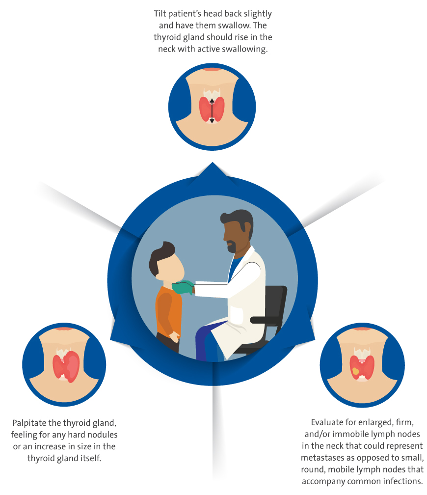 Life in the ‘Gray Zone’ Potentially Malignant Thyroid Nodule