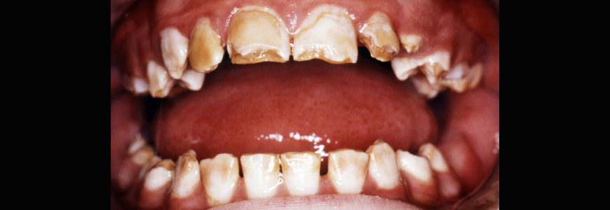 image of an open mouth
