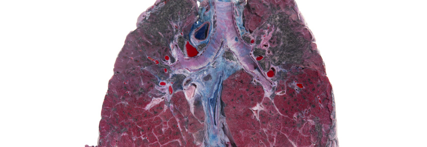 Gross specium of lung