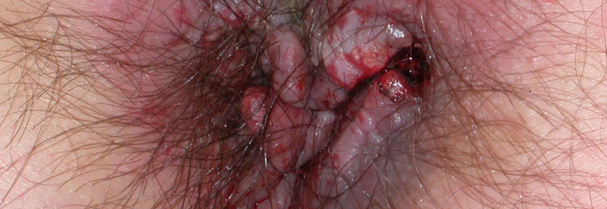 image of anus