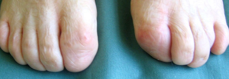 image of toes