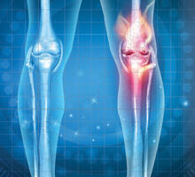 New Blood Test Could Predict Osteoarthritis Risk in Knees