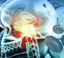 Duke Center for Brain and Spine Metastasis Delivers Coordinated, Multidisciplinary Care