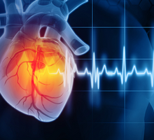 Risk Analysis Strategy Improves Chest Pain Diagnosis
