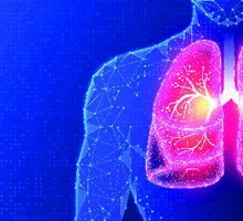 Increasing Number of Lung Transplant Patients Living Longer