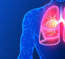 Sarcoid Lung Transplant Requires Advanced Center