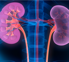 Teen Avoids Dialysis with Paired Kidney Donor Exchange