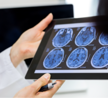 Duke Center for Brain and Spine Metastasis Expands Treatment Options for Patients