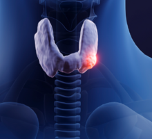 Dedicated Thyroid Cancer Center Delivers Comprehensive Care for Patients