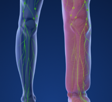Lymphedema and Limb Swelling Clinic Offers Multidisciplinary Care