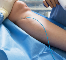 Duke Threatened Limb Clinic Uses Innovations to Restore Circulation