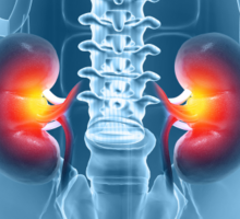 Kidney Transplant for Complex Patient Requires Advanced Expertise