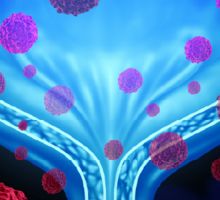 Paving a New Standard for Bladder Cancer Care