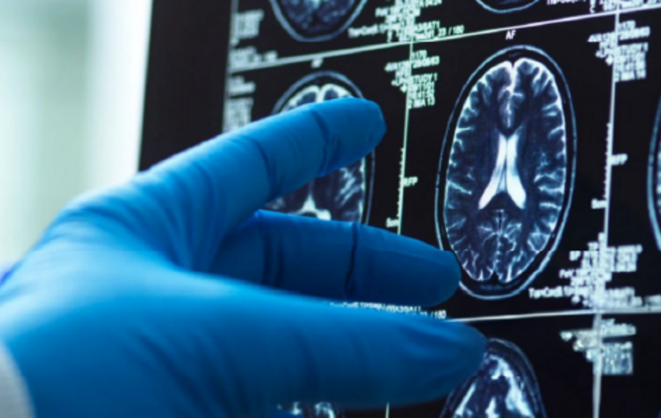 Duke's Enhanced Neurosurgery Care Expands in Morrisville