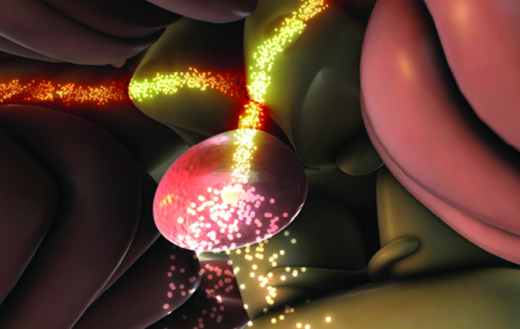 Advancing Laser Ablation To Treat Young Children with Drug-Resistant Epilepsy