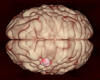 Multidisciplinary Team Expands Minimally Invasive Neuromodulation Treatment Options