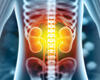 Duke Clinical Trial Targets Improved Kidney Donor Matches
