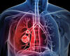 Clinical Trials Explore Immunotherapies for Lung Cancer