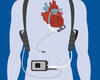 Ventricular Assist Science Advances, Helps More Patients