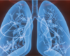 $21M NIH Grant Extends National Lung Transplant Research