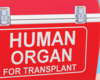 Increasing Transplant Access for Marginalized Populations