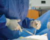 Successful Outcomes for Simultaneous Pancreas, Kidney Transplant