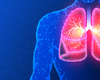 Sarcoid Lung Transplant Requires Advanced Center