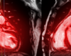 Precision Cardiomyopathy Improves Detection, Treatment