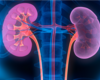 Teen Avoids Dialysis with Paired Kidney Donor Exchange