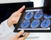 Duke Center for Brain and Spine Metastasis Expands Treatment Options for Patients