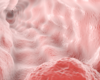 Duke Leads With Comprehensive Care Approach To Treat Esophageal Cancer