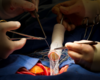 Duke Center for Aortic Disease Combines Expertise in Cardiothoracic and Vascular Surgery