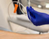 New Immunosuppression Therapy Improves Kidney Transplant Treatment