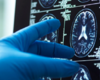 Spine Experts Expand Access to Innovative Endoscopic Approaches