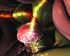 Advancing Laser Ablation To Treat Young Children with Drug-Resistant Epilepsy