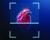 Remote Monitoring Improves Heart Failure Care