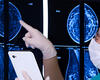 Advanced Diagnostics, Treatment, and Research for Phyllodes Tumors