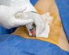 Spine Injection Suite Expands Treatments in Research Triangle