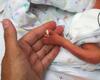 Q&A on Preterm Birth