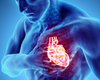 Updates and Key Points on Optimal Medical Therapy for Your Patients With Heart Failure