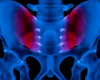 Sacroiliac Joint Pain: The Role of Minimally Invasive Robotic Surgery